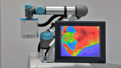 Robot fisioterapeuta Robot fisioterapeuta